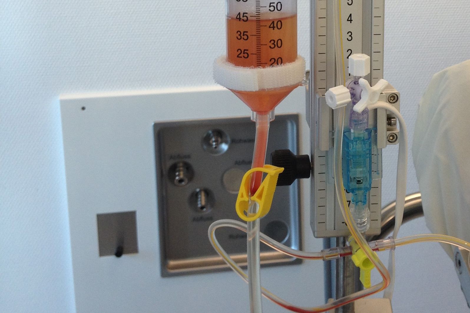 Liquordiagnostik im Klinikum Saarbrücken