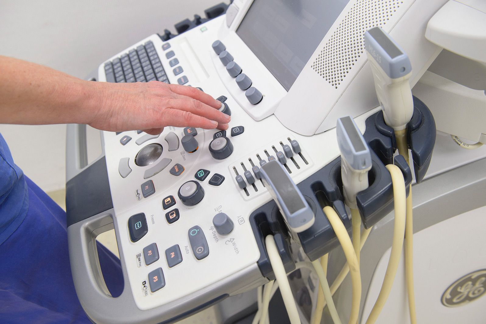 Ultraschallgerät im Klinikum Saarbrücken