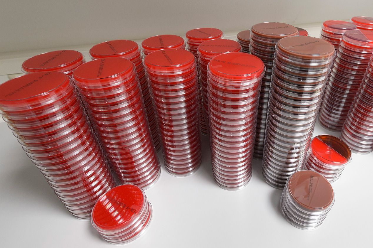 Abklatschplatten zum Nachweis von Keimen