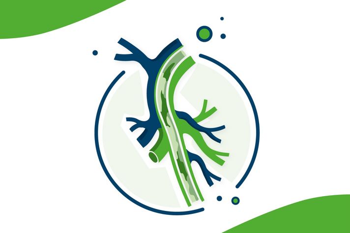 Grafisch dargestellte Gefäße mit einem umschließenden Kreis