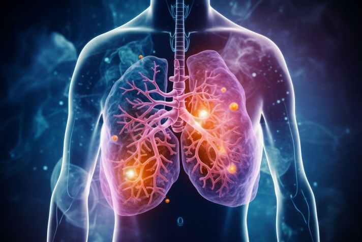 3D rendered illustration of a human lung, Lung cancer, Medical concept, Generative AI