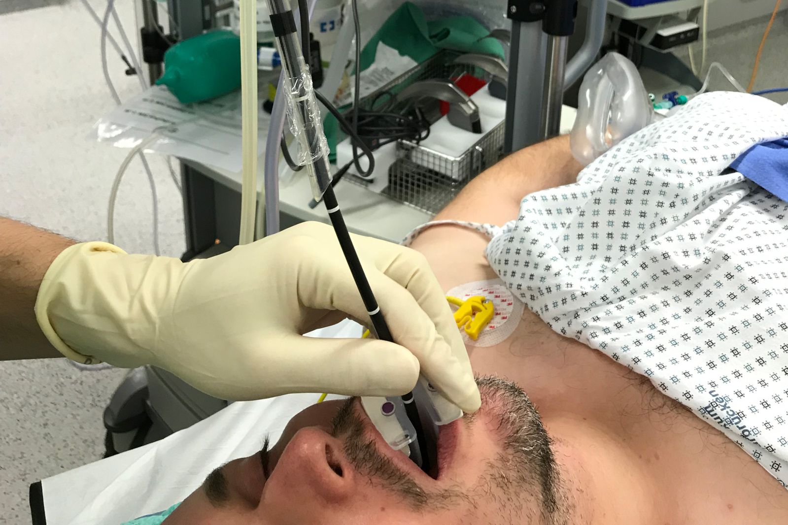 Bronchoskopie eines Intensivpatienten