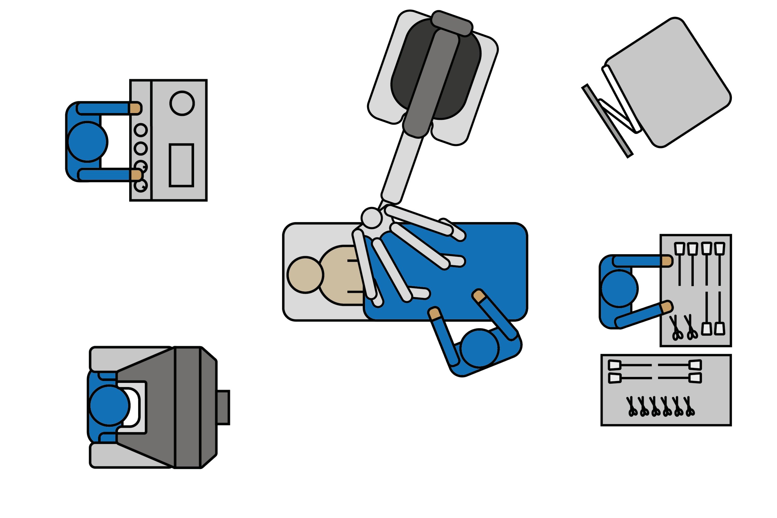 Grafik: Aufbau einer Operation mit dem DaVinci-Roboter - der Operateur sitzt im linken OP-Saal-Bereich an der Konsole und führt die Roboterarme; im Kopfbereich des Patienten überwacht die Anästhesie Narkose und Vitalzeichen; im Zentrum des OPs steht der Operationstisch mit dem Patienten und dem DaVinci-Roboter mit vier Armen; ein bis zwei weitere Monitore stehen in Sichtweise der OTAs und Ärzte, die OP-Pflege richtet Instrumente in der Nähe des OP-Tisches
